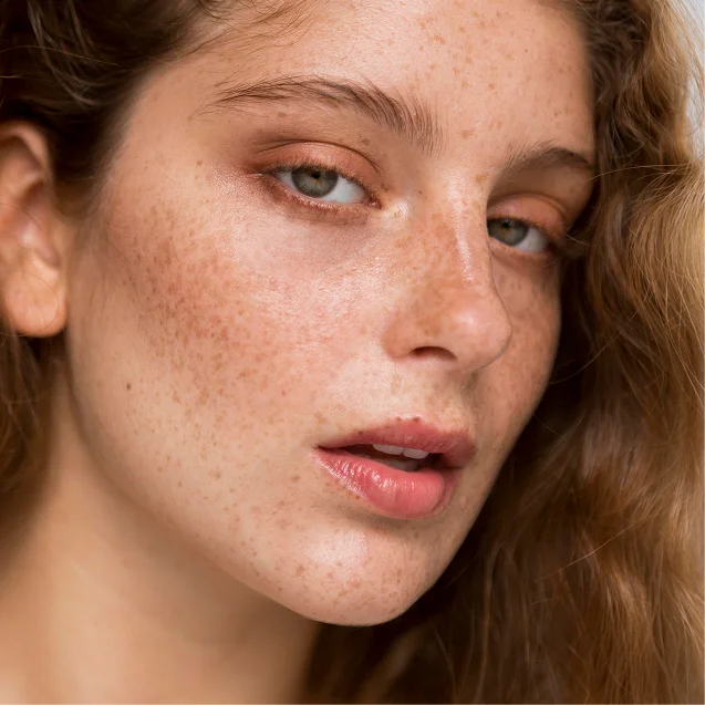 Pigmentation